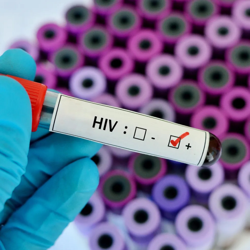 MT registra 316 novos casos de Aids entre janeiro e outubro de 2024, aponta Saúde